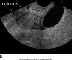 What is this sonographic image showing?