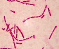 bacillus- single rod
diplobacillus- double rod
streptobacillus- chain of rods