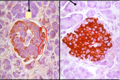 Both these islets contain a antibody against one specific. Which cell for each image and how do ya know