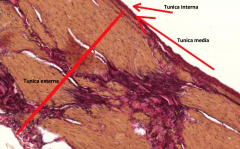 Tunica interna: Endotel  
Tunica media: Meget tyndere
     ift. arterier 
Tunica externa: Består af
     bindevæv.