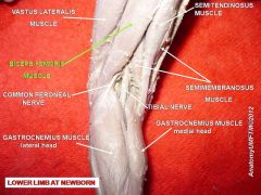 Flex of the hip & ext of the knee most likely would injure the hamstring. The hamstring is composed of the semimembranosus, semitendinosus, and biceps femoris and all 3 components originate at the ischial tuberosity, rectus fem is 1 of 4 of quad, ...