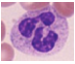 Hvilken type blodcelle er dette?