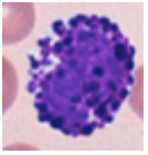 Hvilken type blodcelle er dette?