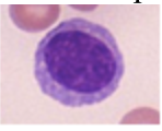 Hvilken type blodcelle er dette? (den er aktiv)