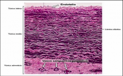 Esta membrana en este tipo de arterias elásticas
no se distingue con claridad porque es una de las muchas láminas elásticas en la pared del vaso. Suele identificarse sólo porque es la lámina elástica más interna de la pared arterial.