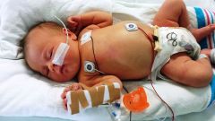 Recién nacido de 1 semana de edad con diagnostico de granulomatosis infantiseptica, ¿Cuál es el período de incubación? 