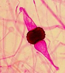 If it has sporangium and sporangiophores, it is reproducing Asexually. If it has zyosporangium and zygosphores, it is reproducing sexually.
