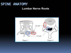 BELOW the pedicle of L4 and at the TOP of the intervertebral foramen

Remember, in the lumbar region, spinal nerves exit below the vertebra with the same number. So, the L4 nerve exits below the L4 vertebra. The spinal nerves also exit at the to...