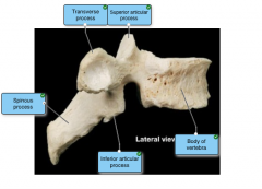 lateral thoracic vertebrae