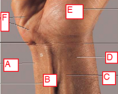 1. Identify.
(A and F are on medial side of body)

2. What can be found between A and B?