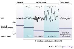 What is the difference between awake, non-REM sleep, and REM sleep on an EKG?
Where do Sleep spindles occur? Sharp wave ripples (and delta waves)?