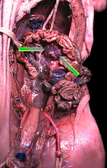 a fold of the peritoneum that attaches the stomach, small intestine, pancreas, spleen, and other organs to the posterior wall of the abdomen