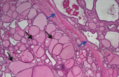 What does this histologic image of the thyroid show?