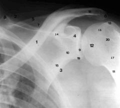 Radiographie normale de l’épaule.