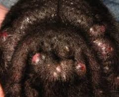 A German shephard presents to your clinic with what the owner describes as 'acne' on its chin and around its face. What is the most likely diagnosis?