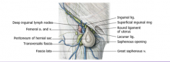 FEMORAL HERNIAS

The proximal opening (base) of the femoral canal is the femoral ring. The femoral ring is a weak area on the anterior abdominal wall where femoral hernias begin.

The femoral hernias go from femoral ring 









→fe...