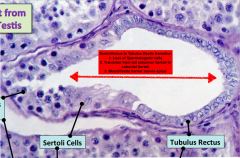 - Again ORIENT YOURSELF IN TESTIS BY using the spermatocytes near the BM as a guide and then decide what you are looking at