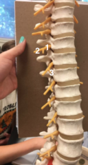 1. Spinal Nerve
2. Ventral Rami
3. Dorsal Rami
