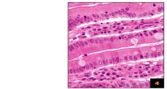 Tissue that partakes in secretion and absorption as well but consists of one layer of column shaped cells