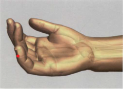 0,1 Tsun por encima y lateralmente hasta el ángulo
ungueal cubital del dedo meñique