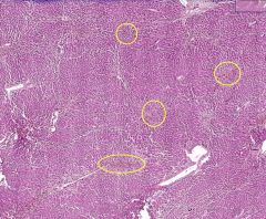 What type of tissue is this?

What are the areas in the yellow circles an example of?