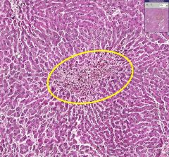 What is shown above?

What type of cells would are seen in the yellow circled area?