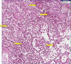 Lung (alveoli)

RBCs