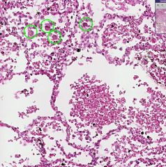 What type of cells are shown in the green circles?

 What organ is this?
