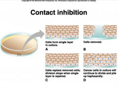 Cancer cells lose normal contact inhibition, and continue to divide despite bumping into other cells.