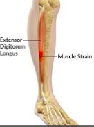 Extensor digitorum longus (EDL)															
Origin

Upper 1/2, medial surface of the fibula andlateral tibial condyle 
 Pathway

Moving distally, tendon forms lateral to EHLrunning over the dorsal aspect of the foot															       
 Inser...