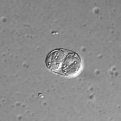 Phylum Apicomplexa, Class Coccidea

Have intermediate hosts
Have tachyzoites & bradyzoites
1:2:4 Oocyst : Sporocyst : Sporozoite ratio

Includes 
Toxoplasma gondii
Sarcocystis sp. 