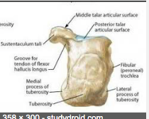 • Lateral process 
• Tubercle 
