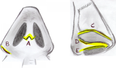 D - placed along the caudal edge of the lateral crura