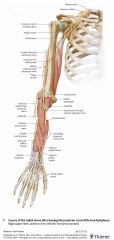 (C5-T1)
Posterior compartment of the upper arm and forearm
Lies in the radial groove of the humerus 
Can be damaged there
Divides into the 
Superficial radial nerve (sensory) and 
Posterior inerosseus nerve (motor) 
Just above the elbow