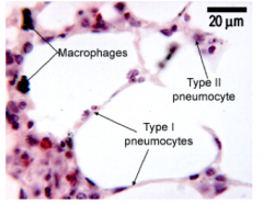 (Dust cell, alveolar phagocyte) 
=principal mononuclear phagocyte of the alveolar surface