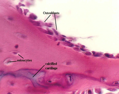 Derived from mesenchymal stem cells; forms bone organic matrix and its mineralization (osteoid); also known as immature bone cells
