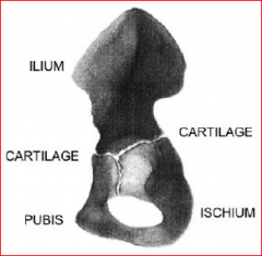 Ilium, ischium, pubis joined at triradiate cartilage to form acetabulum 