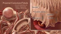Proximal Convulated Tubule