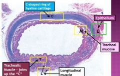 Trachealis muscle (in front of longitudinal)
