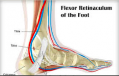 Flexor retinaculum  
-Medial malleolus → medial aspect of the calneus 
 
-Role is to prevent the tendons of the deep leg muscles from

								bowstringing as they round the medial malleolus 

-Contents include tibialis posterior, flexor ...