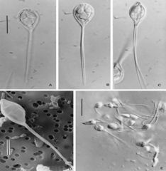 Usually a fish parasite
Gi sx (esp in AIDS pts)
Henneguya salminicola and Myxobolus plectroplites
Spores look like sperm and are made of chitin