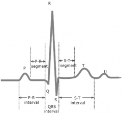 Recording of the electrical current as APs pass through the heart
P wave
QRS Complex
T wave