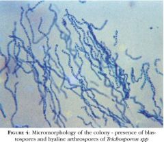 Superficial mycoses


Causes: White piedra (hair shaft infection)
Macro feature: white to tan nodules on hair shaft


Characteristics:
-Mycelia grow inward and penetrate hair cuticle
-septate hyphae, arthroconidia, blastoconidia