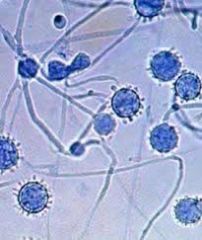 Saprophytic Septate Fungi (hyalohyphomycetes)


Contaminant


-white colonies
-spiny, tuberculate (having tubers) conidia
