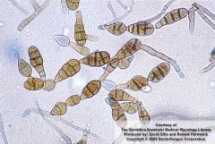 Saprophytic Septate Fungi (Phaeohyphomycetes)


Allergen, Plant pathogen


-granulomatous lesions
-multicellular conidia