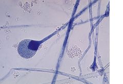 Zygomycetes (aseptate, zygospore, sporangia, ribbon like hyphae)


Causes: Zygomycosis (mucormycosis)-rhinocerebral, pulmonary, gastrointestinal, subcut., disseminated infection


-aerial hyphae can grow high (cotton candy appearance)
-intercalary...