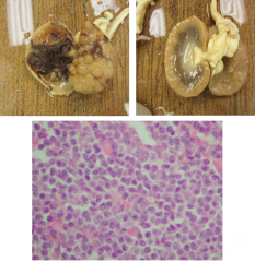 tissue from 11 yo MN DSH.  2 day hx of constipation and 5 day hx of anorexia.  bx reveals densely cellular infiltrative sheet of uniform round cells expanding and disrupting kidney parenchyma.  mdx? ddx?