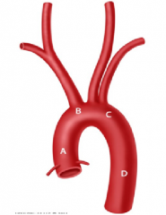 Patient involved in a motor vehicle accident most likely will injure which part of the aorta?