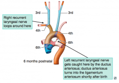 No 5th aortic arch!