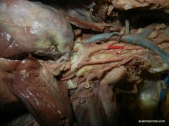 identify brachiocephalic artery and 
left subclavian artery